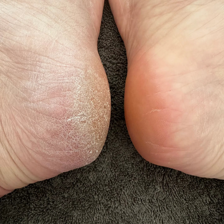 KB x OPI E-File Pedi Diamond Bit