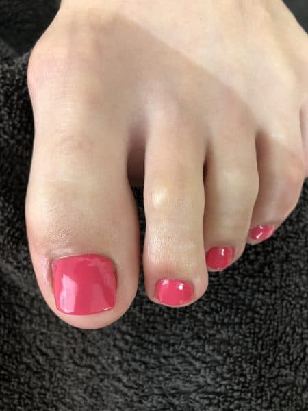 How To Rebuild A Damaged Toenail