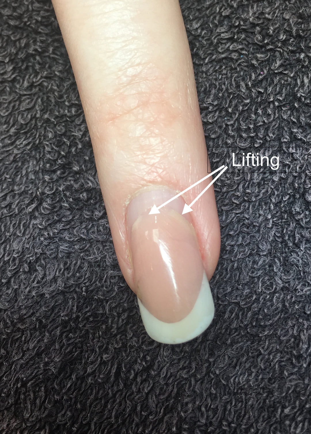 How to deal with nail service breakdown