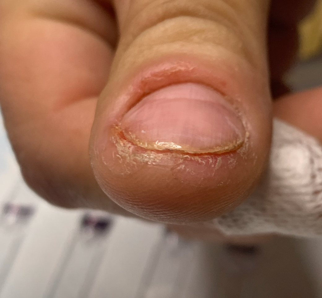 The Hidden Dangers of Counterfeit Nail Products: Protecting Yourself as a Consumer