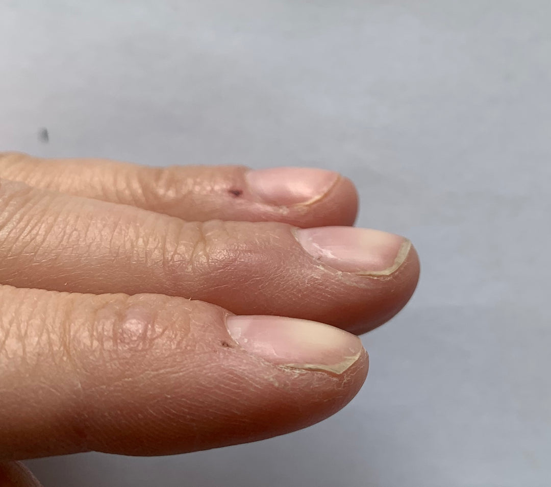 What is the difference between the nail plate and nail bed?