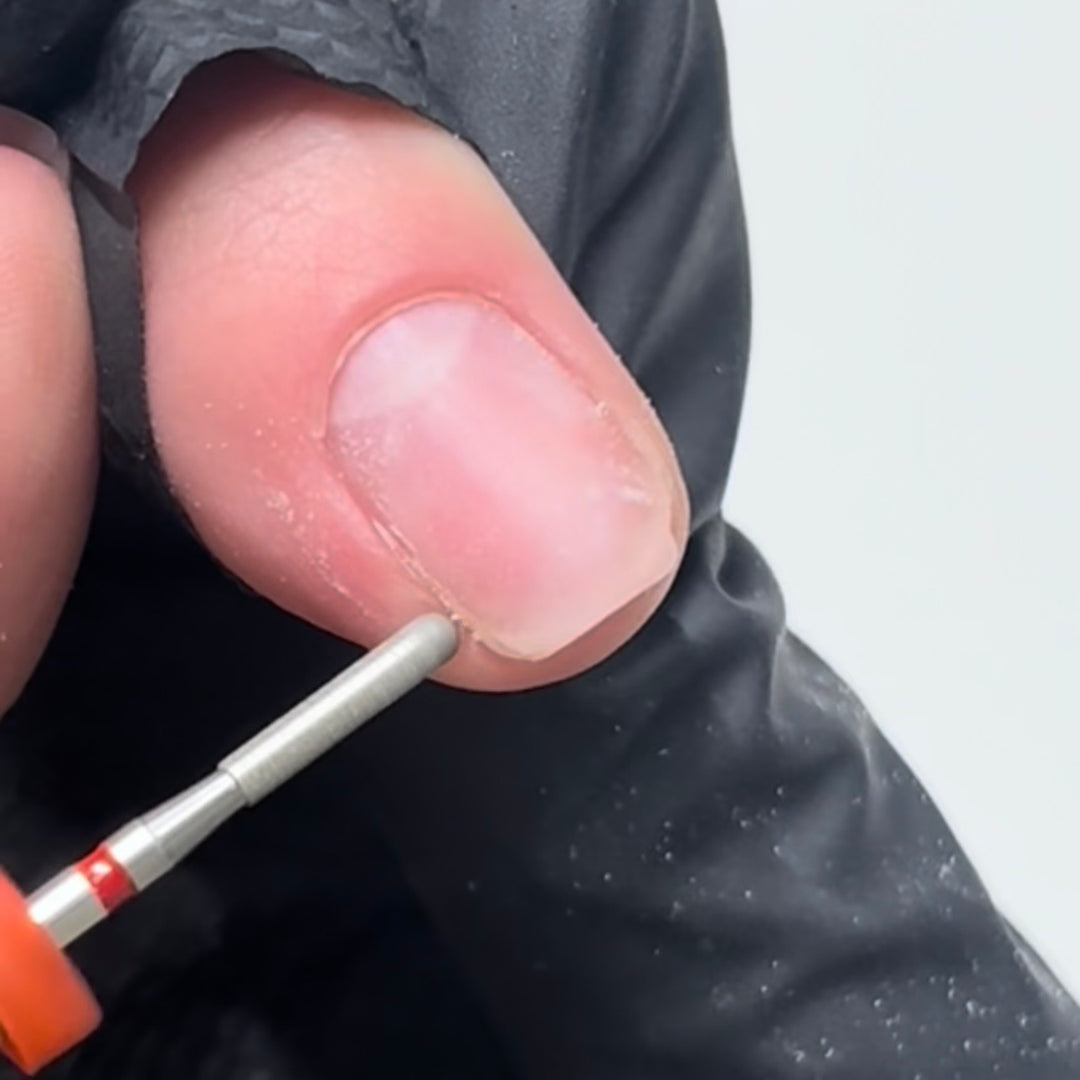 KB Rounded Skin Refining Bit